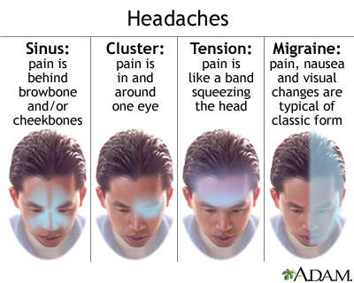 HEADACHE AND OTHER NEURALGIAS